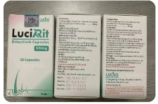 利特昔替尼（RITLECITINIB）：斑秃患者的新曙光？